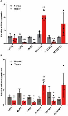 Development of a prognostic model based on different disulfidptosis related genes typing for kidney renal clear cell carcinoma
